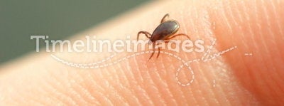 Starved Tick Seeking Right Place on Host Body