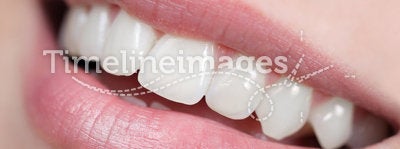 White, shiny and healthy smile
