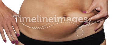 Woman's belly fat