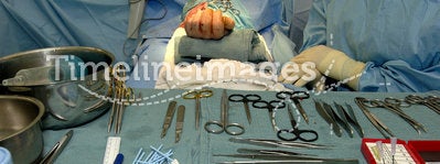 Surgery-Hand Operation