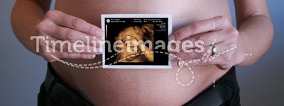 Pregnant mother 3D baby echo