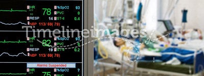 Patients monitoring in ICU