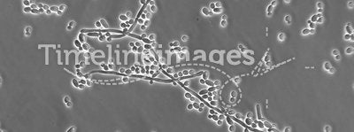 Stock Photograph of Candida albicans