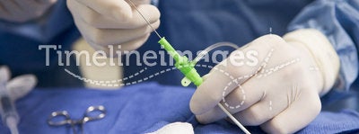 Surgeon Inserting Tube Into Patient During Surgery