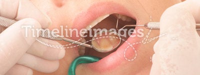 At the dentist -diagnosis- close up